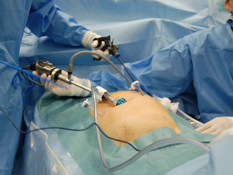 リンパ節の腫れ